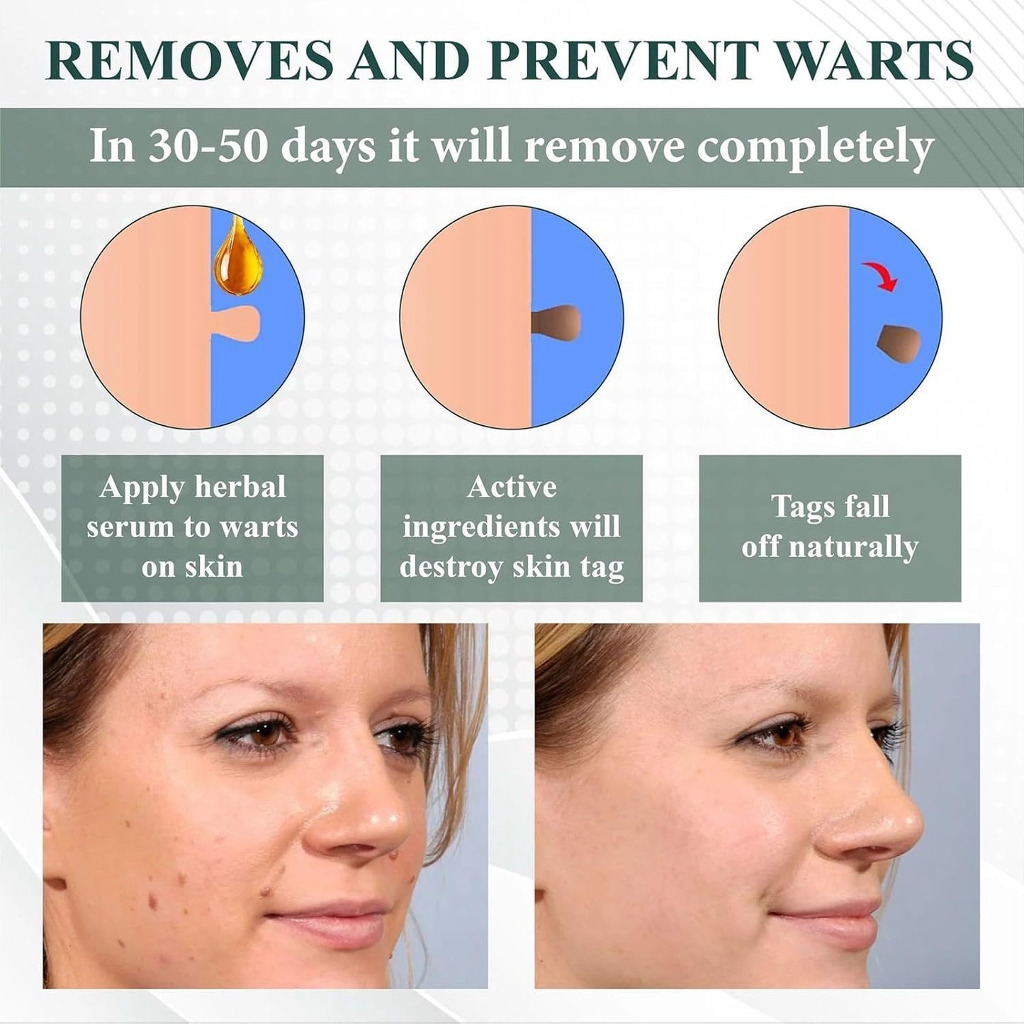 NatureErase Instant Mole Spot Removal Gel